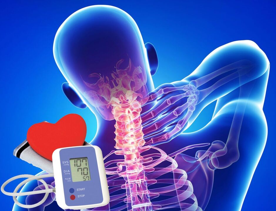 Servikal osteokondroz için kan basıncının tezgahı