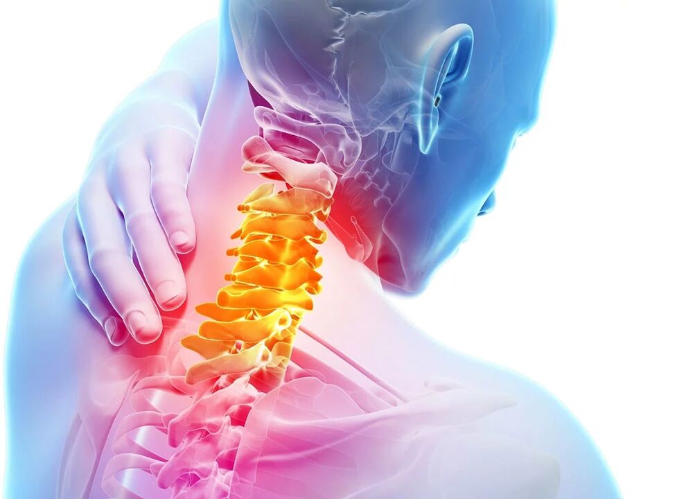 Servikal osteokondroz