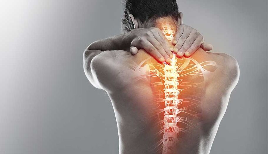 Osteokondroz nedeniyle omurgada ağrı